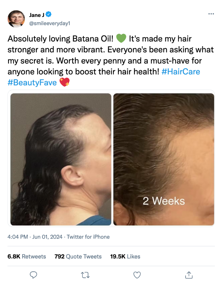 VitaHair Miracle Growth Oil